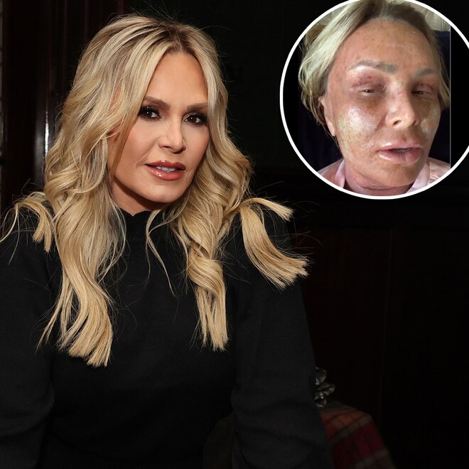 Tamra Judge’s Mom Roasts Her Over Her Post Cosmetic Procedure Look
